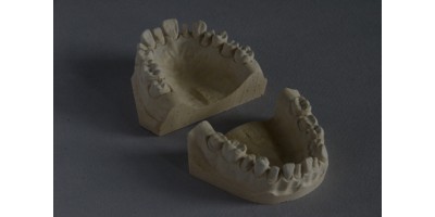 Set of maxillary and mandibular casts with gnathological occlusion with prepared tooth adjacent to non-preped tooth for prosthetics Art.no.1001-04